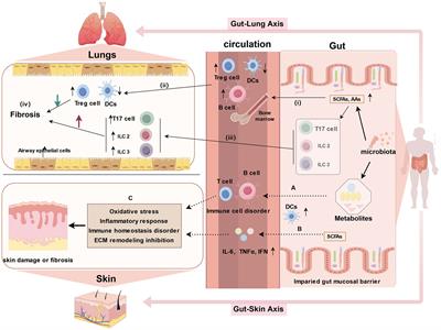 Gut microbiome and metabolomics in systemic sclerosis: feature, link and mechanisms